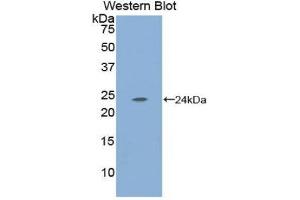 Western Blotting (WB) image for anti-Carbonic Anhydrase I (CA1) (AA 15-223) antibody (ABIN1173857)