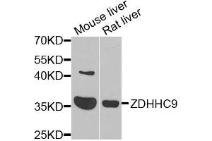 Western blot analysis of extracts of various cells, using ZDHHC9 antibody. (ZDHHC9 anticorps)