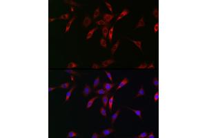 Immunofluorescence analysis of NIH/3T3 cells using NKIR Rabbit pAb (ABIN7268903) at dilution of 1:100 (40x lens). (NKIRAS1 anticorps  (AA 118-192))