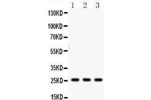 Anti- SFTP A1/2 Picoband antibody, Western blotting All lanes: Anti SFTP  at 0. (SFTPA1/ 2 (AA 206-237), (C-Term) anticorps)