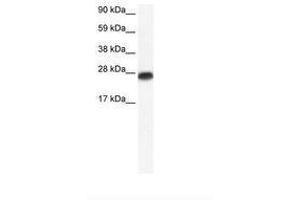 Image no. 1 for anti-Myogenic Factor 6 (MYF6) (AA 66-115) antibody (ABIN6735892) (MYF6 anticorps  (AA 66-115))