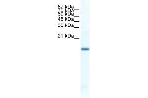 WB Suggested Anti-FERD3L Antibody   Titration: 1. (FERD3L anticorps  (N-Term))