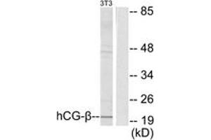 Western blot analysis of extracts from NIH-3T3 cells, using hCG beta Antibody.