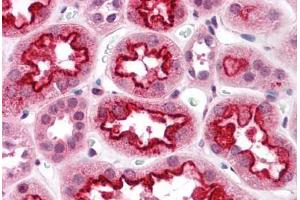 Human Kidney: Formalin-Fixed, Paraffin-Embedded (FFPE) (TAB3 anticorps  (N-Term))