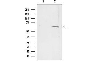 anti-Squalene Epoxidase (SQLE) (C-Term) antibody