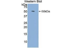 Western blot analysis of the recombinant protein. (FGF1 anticorps  (AA 1-155))