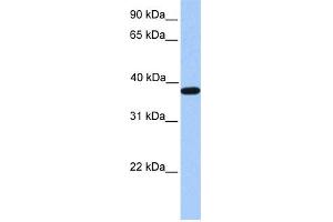 WB Suggested Anti-ACTRT2 Antibody Titration: 0. (ACTRT2 anticorps  (C-Term))