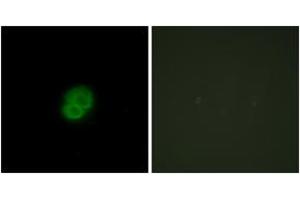 Immunofluorescence analysis of HepG2 cells, using ARMCX2 Antibody. (ARMCX2 anticorps  (AA 321-370))