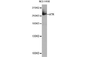 Western blot analysis of extracts of NCI-H460 cells, using ATR Antibody (ABIN5974366) at 1/1000 dilution. (ATR anticorps)