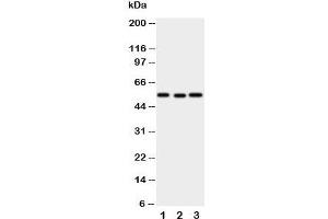 Western blot testing of XIAP antibody and Lane 1:  SMMC-7721;  2: HeLa;  3: A431 cell lysate (XIAP anticorps  (N-Term))