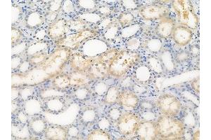 ABIN6259139 and ABIN6276100 at 1/100 staining human normal kidney tissue by IHC-P.