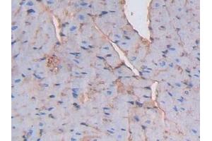 Detection of ALB in Mouse Heart Tissue using Polyclonal Antibody to Albumin (ALB)