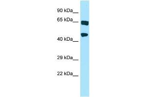 WB Suggested Anti-HABP4 Antibody Titration: 1. (HABP4 anticorps  (N-Term))