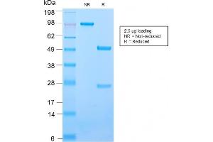 SDS-PAGE Analysis Purified CD50 Rabbit Recombinant Monoclonal Antibody (ICAM3/2873R).