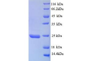 SDS-PAGE (SDS) image for TIMP Metallopeptidase Inhibitor 3 (TIMP3) (AA 30-208), (partial) protein (His tag) (ABIN5712798)