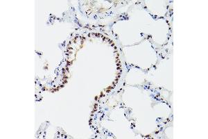 Immunohistochemistry of paraffin-embedded mouse lung using CPSF6 Rabbit pAb (ABIN6128924, ABIN6138974, ABIN6138975 and ABIN6221646) at dilution of 1:100 (40x lens).