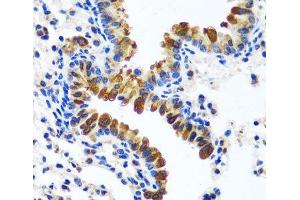 Immunohistochemistry of paraffin-embedded Mouse lung using CAMLG Polyclonal Antibody at dilution of 1:100 (40x lens).