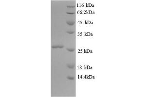 (Tris-Glycine gel) Discontinuous SDS-PAGE (reduced) with 5% enrichment gel and 15% separation gel. (Orosomucoid 2 Protein (ORM2))