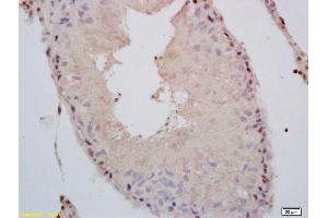 Formalin-fixed and paraffin embedded rat testis labeled with Rabbit Anti phospho-Androgen Receptor(Ser578) Polyclonal Antibody, Unconjugated (ABIN730123) at 1:200 followed by conjugation to the secondary antibody and DAB staining