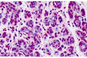 Human Breast: Formalin-Fixed, Paraffin-Embedded (FFPE) (Bcl-2 anticorps  (FITC))