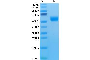 Mouse NKG2D on Tris-Bis PAGE under reduced condition. (KLRK1 Protein (AA 90-232) (Fc Tag))