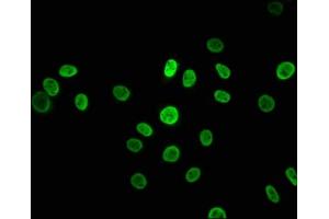 Immunofluorescence staining of A549 cells with ABIN7127548 at 1:43. (Recombinant HNRNPK anticorps)