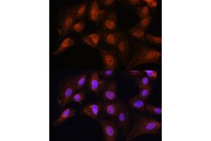 Immunofluorescence analysis of C6 cells using BCL3 Rabbit pAb (ABIN6134239, ABIN6137509, ABIN6137510 and ABIN7101379) at dilution of 1:100. (BCL3 anticorps  (AA 300-400))