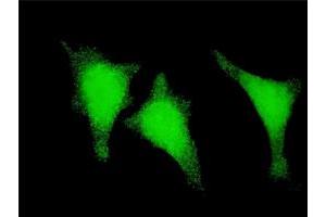 Immunofluorescence of monoclonal antibody to STAU1 on HeLa cell. (STAU1/Staufen anticorps  (AA 401-496))
