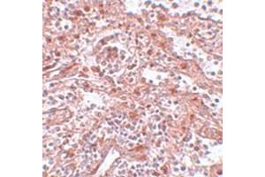 Immunohistochemical staining of human spleen tissue with LIN28 polyclonal antibody  at 5 ug/mL dilution. (LIN28A anticorps  (C-Term))