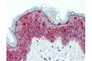 IHC-P Image Immunohistochemical analysis of paraffin-embedded human skin, using Galanin Receptor 2, antibody(10 μg/ml).