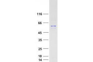 Validation with Western Blot