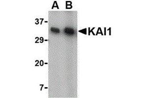 Western Blotting (WB) image for anti-CD82 (CD82) (C-Term) antibody (ABIN2472638) (CD82 anticorps  (C-Term))