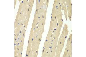 Immunohistochemistry of paraffin-embedded mouse heart using USP7/HAUSP antibody (ABIN6132279, ABIN6150031, ABIN6150033 and ABIN6217612) at dilution of 1:200 (40x lens).