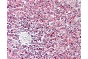 Anti-IST1 antibody IHC staining of human spleen. (IST1 anticorps  (AA 125-317))