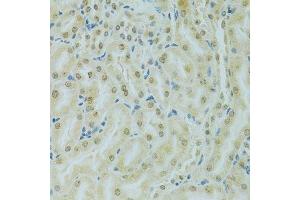 Immunohistochemistry of paraffin-embedded mouse kidney using RCC1 antibody. (RCC1 anticorps  (AA 1-240))