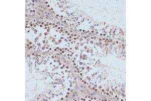 Immunohistochemistry of paraffin-embedded mouse testis using Phospho-BRC-S1423 antibody (ABIN3019880, ABIN3019881, ABIN3019882 and ABIN6225497) at dilution of 1:100 (40x lens). (BRCA1 anticorps  (pSer1423))