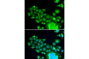 Immunofluorescence analysis of HeLa cells using FZR1 antibody (ABIN6130399, ABIN6140852, ABIN6140854 and ABIN6221196). (FZR1 anticorps  (AA 224-493))