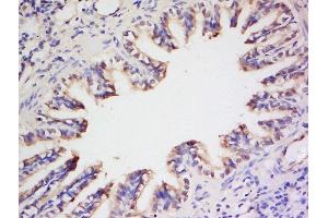 Formalin-fixed and paraffin embedded rat lung labeled with Anti- Preproendothelin 1 Polyclonal Antibody, Unconjugated  at 1:200 followed by conjugation to the secondary antibody and DAB staining (Prepro-Endothelin-1 (AA 16-110) anticorps)