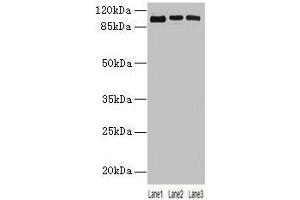 Western blot All lanes: ZNF546 antibody at 4 μg/mL Lane 1: A549 whole cell lysate Lane 2: 293T whole cell lysate Lane 3: Hela whole cell lysate Secondary Goat polyclonal to rabbit IgG at 1/10000 dilution Predicted band size: 99 kDa Observed band size: 99 kDa (ZNF546 anticorps  (AA 1-300))