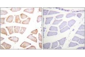 Immunohistochemistry analysis of paraffin-embedded human skeletal muscle tissue, using Akt (Ab-129) Antibody. (AKT1 anticorps  (AA 95-144))