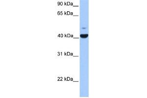 WB Suggested Anti-FGFR1OP Antibody Titration: 0. (FGFR1OP anticorps  (N-Term))