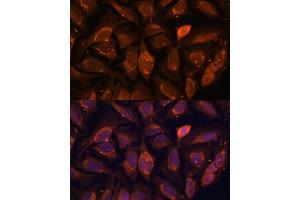 anti-NADH Dehydrogenase (Ubiquinone) 1 alpha Subcomplex, 4-Like 2 (NDUFA4L2) (AA 1-87) antibody