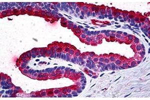 Human Prostate: Formalin-Fixed, Paraffin-Embedded (FFPE) (TIMP2 anticorps  (AA 27-221))