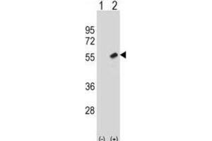 Western Blotting (WB) image for anti-Retinoblastoma Binding Protein 7 (RBBP7) antibody (ABIN2998665)
