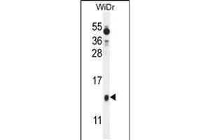 Western blot analysis in WiDr cell line lysates (35ug/lane).