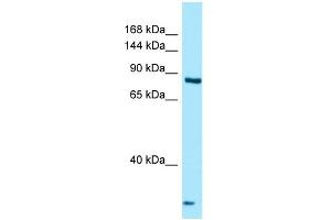 Western Blotting (WB) image for anti-Thyroid adenoma-associated protein (THADA) (C-Term) antibody (ABIN2789989) (THADA anticorps  (C-Term))