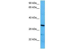 Host:  Mouse  Target Name:  MBD3  Sample Tissue:  Mouse Brain  Antibody Dilution:  1ug/ml (MBD3 anticorps  (N-Term))