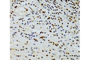 Immunohistochemistry of paraffin-embedded Human vermiform appendix using ALYREF Polyclonal Antibody at dilution of 1:100 (40x lens).