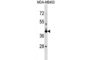 Western Blotting (WB) image for anti-SRR1 Domain Containing (SRRD) antibody (ABIN2999110)