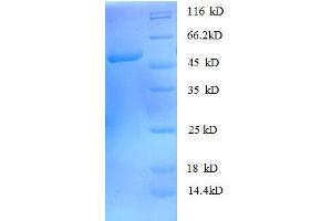 rho GDP Dissociation Inhibitor (GDI) alpha (ARHGDIA) (AA 2-204), (full length) protein (GST tag) (ARHGDIA Protein (AA 2-204, full length) (GST tag))